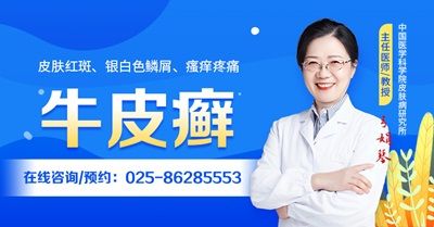 近期公开!南京好的牛皮癣医院排名：南京市哪里治疗牛皮癣好