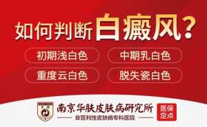整合优势资源，服务白斑患者——南京华肤白癜风专病门诊正式揭牌