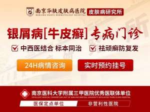 南京牛皮癣专病门诊怎么预约-南京华肤牛皮癣医院挂号