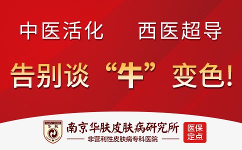 得了牛皮癣怎么办“南京看牛皮癣哪家医院比较好”