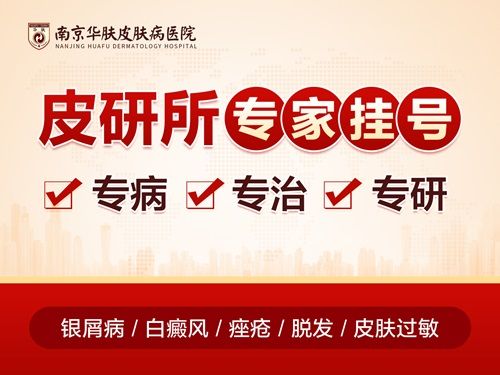 南京华肤牛皮癣专病门诊：中医调理+西医治疗双管齐下