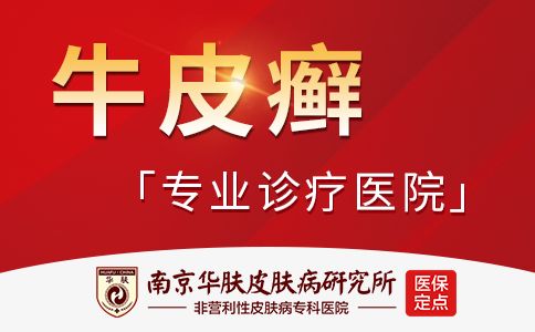 银屑病饮食禁忌有哪些“南京看银屑病医院老牌专科”